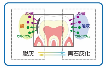 再石灰化