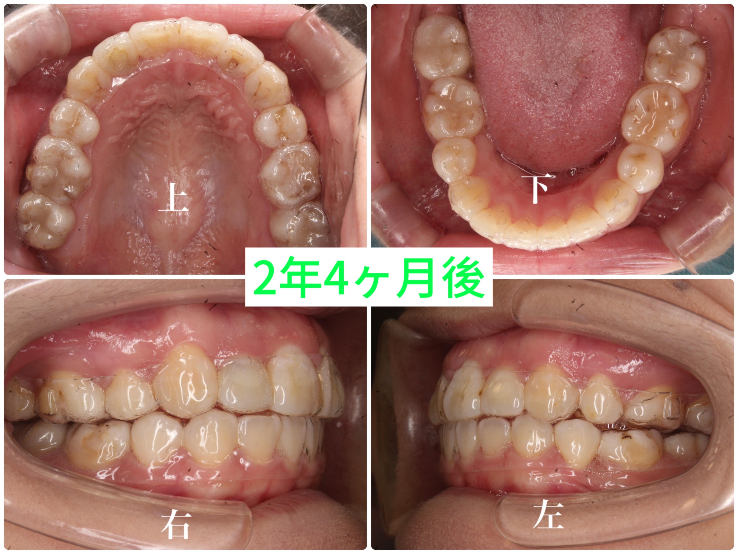 症例