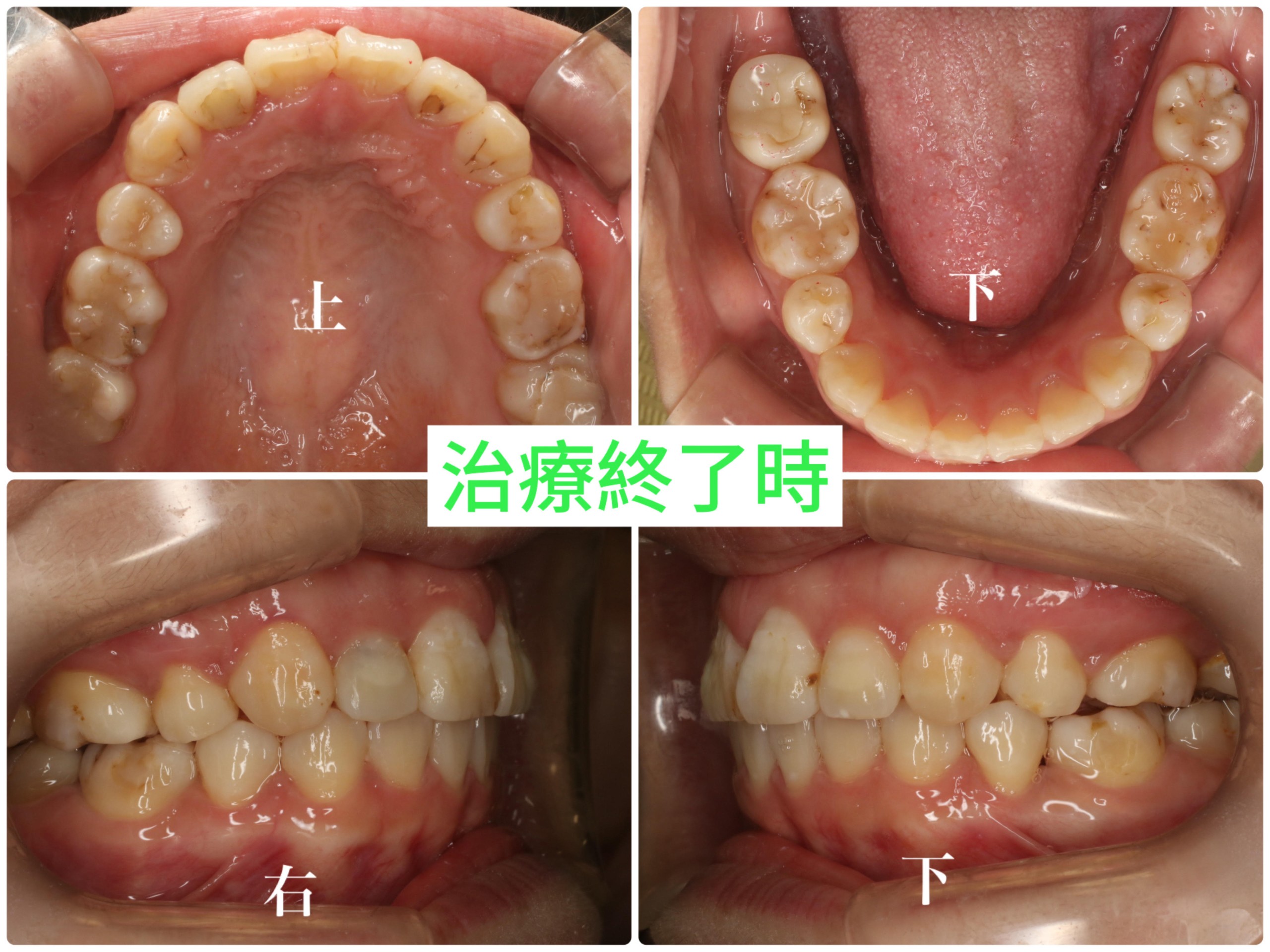 症例